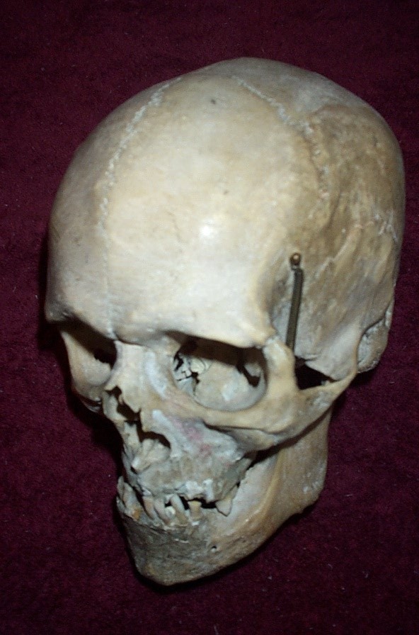 Old Medical Skull