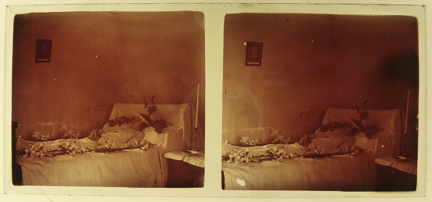 Rare Postmortem Stereogram (19??)