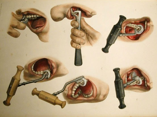 8 Painful Surgical Practices In Ancient Times | Fab.ng